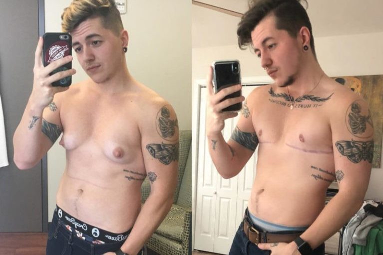 I present to you the FTM Live Cam model – welcome!