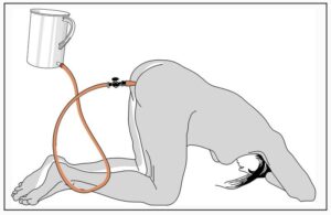 Enema BDSM Cams Into the World of Dark Arts